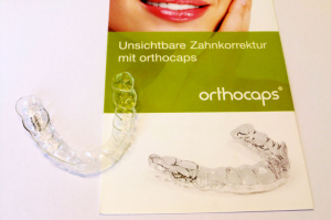 Unsichtbare Zahnspange - Orthocaps